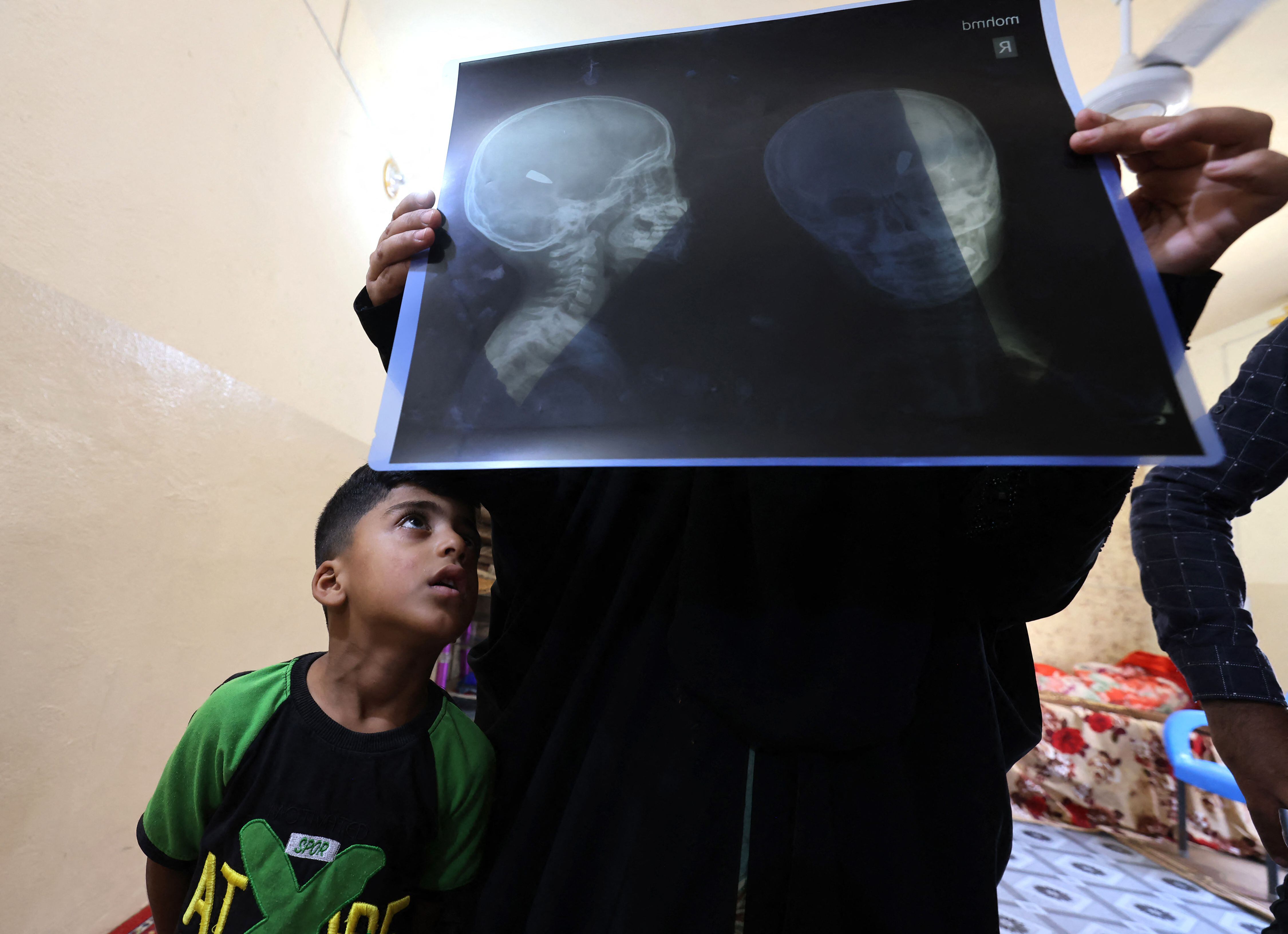 Muhammad Akram, de 4 años, fue víctima de una bala pérdida mientras estaba en su casa. Foto: AFP