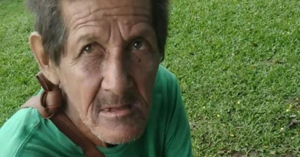 Miguel Martínez Báez, un habitual de 66 años, se encontraba durmiendo cerca del hospital local, la madrugada del pasado lunes 24 de junio, cuando, en apariencia, dos jóvenes lo atacaron a pedradas. (Foto: suministrada por Edgar Chinchilla, corresponsal GN)
