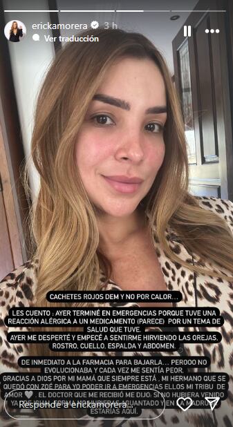 Ericka Morera compartió en su cuenta de Instagram que debido a una reacción alérgica a un medicamento, necesitó acudir a emergencias.