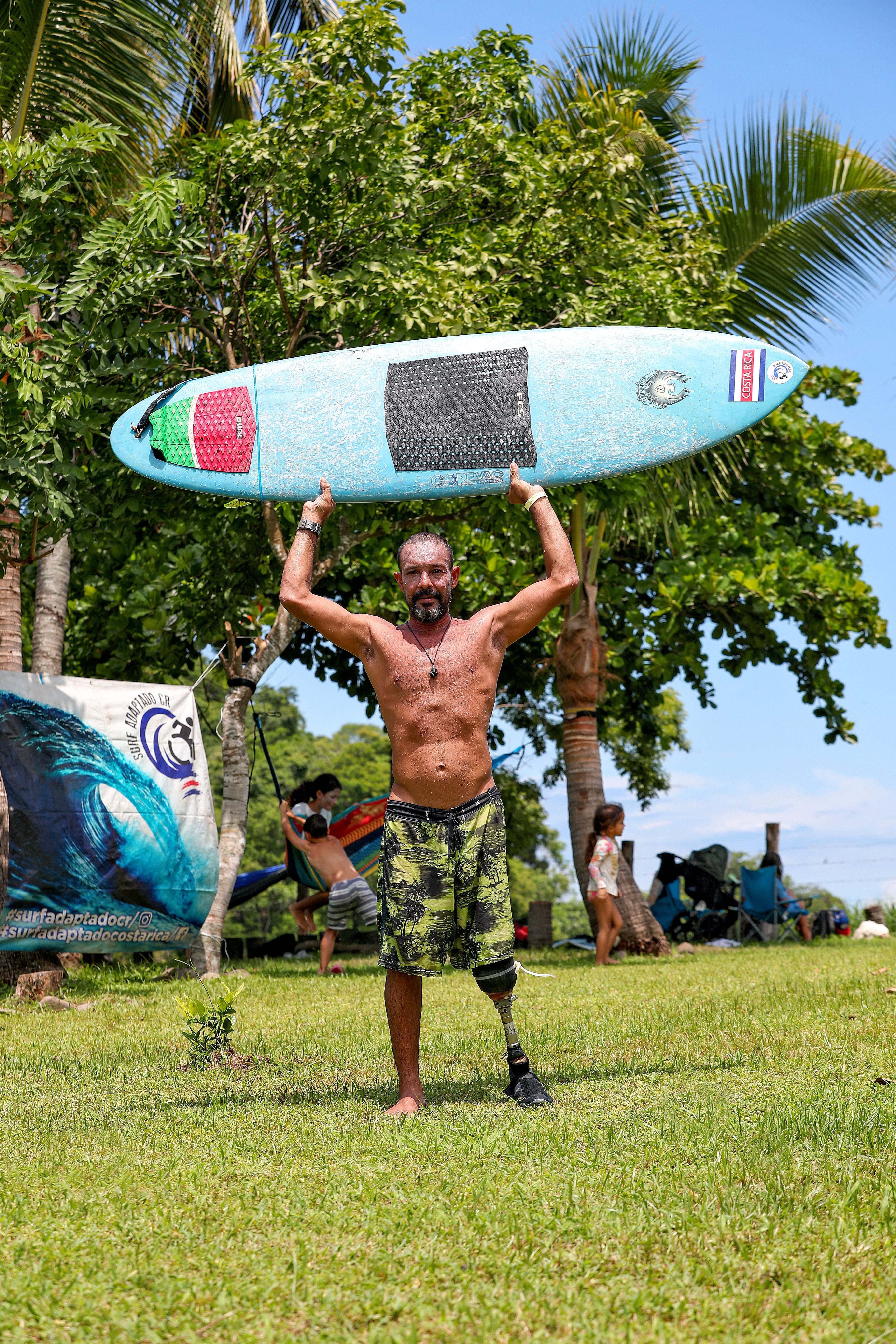 Baldir Vallejo comenzó a surfear desde una edad temprana. A los 23 años sufrió un accidente de tránsito que resultó en la amputación de su pierna izquierda y, desde 2017, no ha parado de competir en surf adaptado.