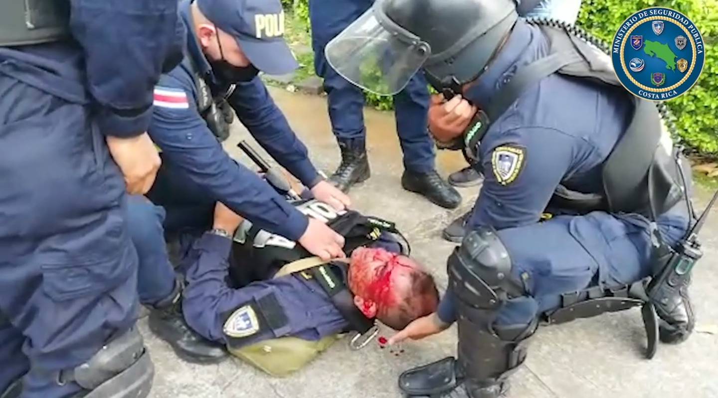 Oficiales de la Fuerza Pública heridos en la batalla campal contra manifestantes frente a Casa Presidencial el 12 de octubre del 2020