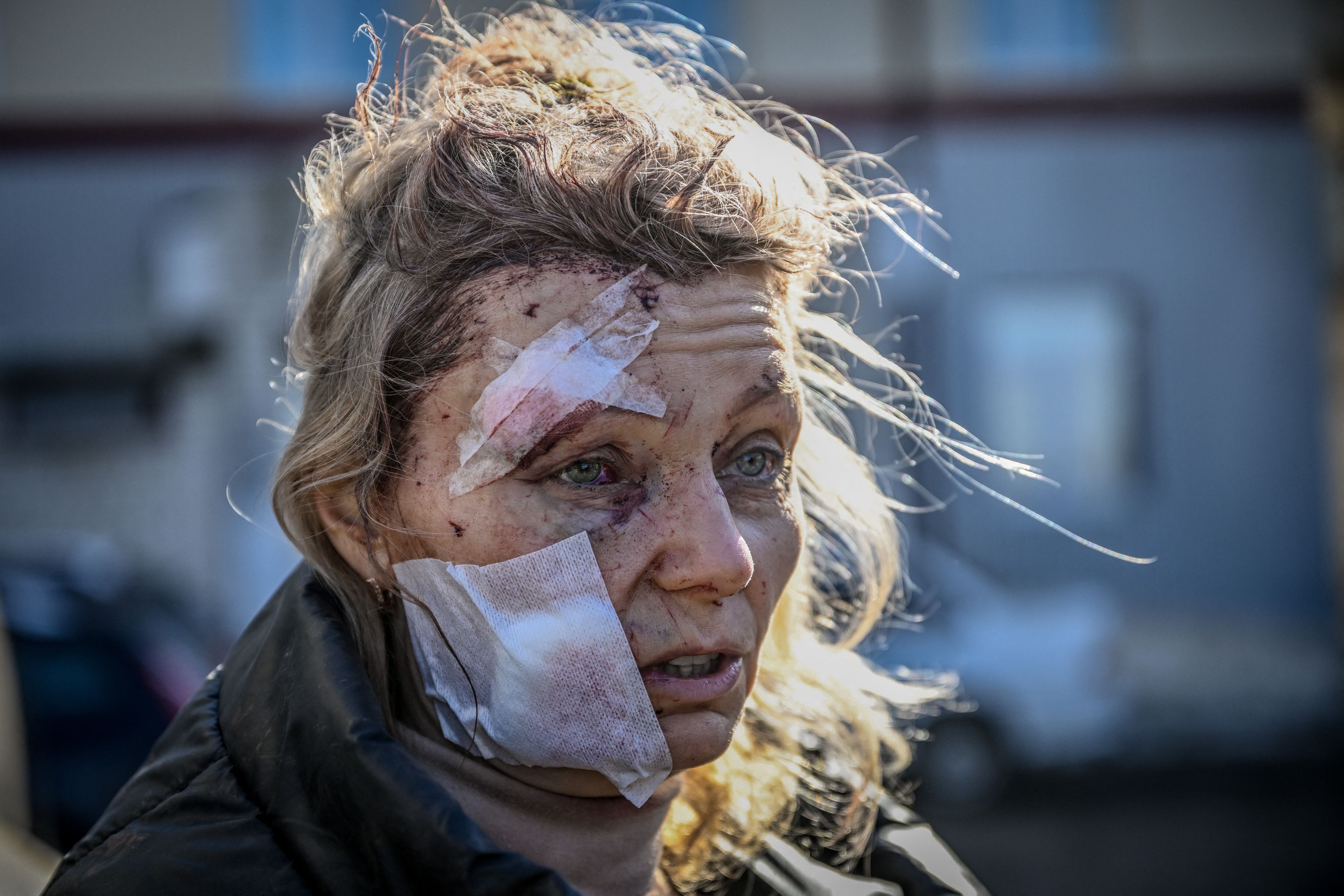 El 24 de febrero de 2022, Olena Kurylo, una maestra de 52 años, lucía conmocionada frente a un hospital después del bombardeo de la ciudad de Chuguiv, en el este de Ucrania. 