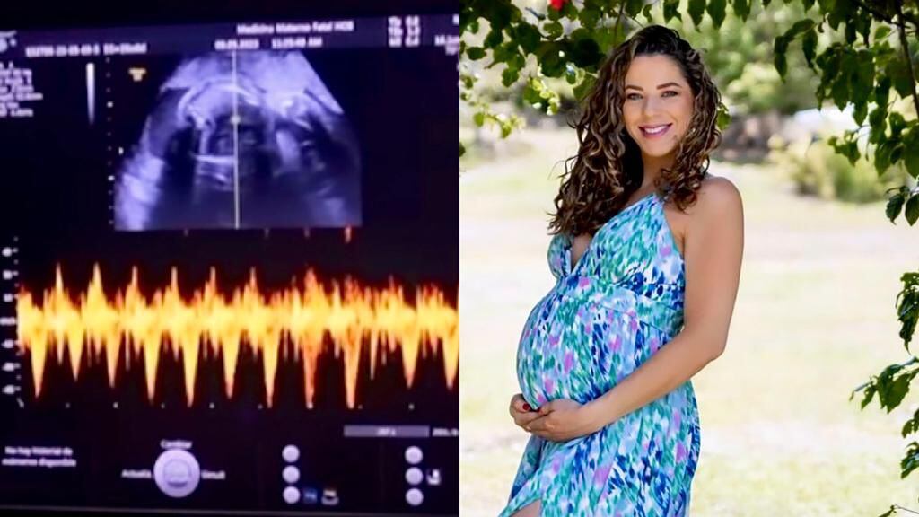 Lussania Víquez compartió un video en el que se escuchan los latidos de sus bebés. 