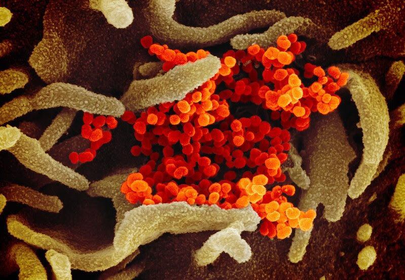 Esta es la imagen del virus SARS-CoV-2, causante de la covid-19 cuando ingresa e interactúa con las células humanas.