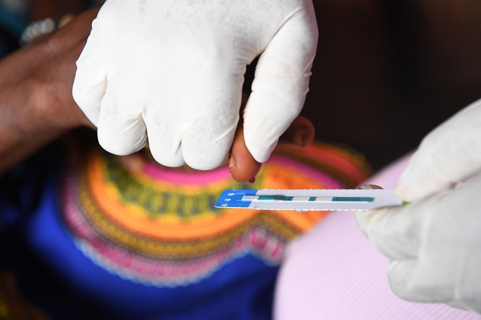 Una cuarta parte de las personas con VIH no recibe tratamiento. ONUSIDA llama a aumentar recursos para poner fin a la pandemia de sida.