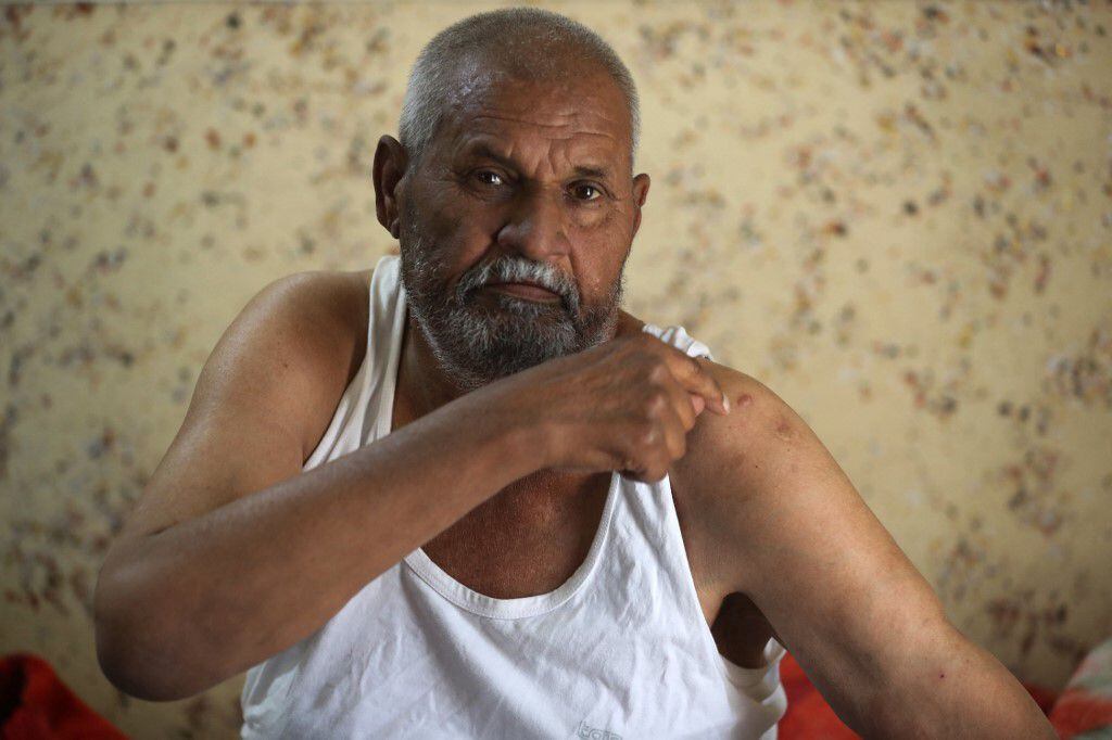 Saad Abbas, de 59 años resultó herido en su vivienda y ahora no puede mover su brazo. Foto: AFP
