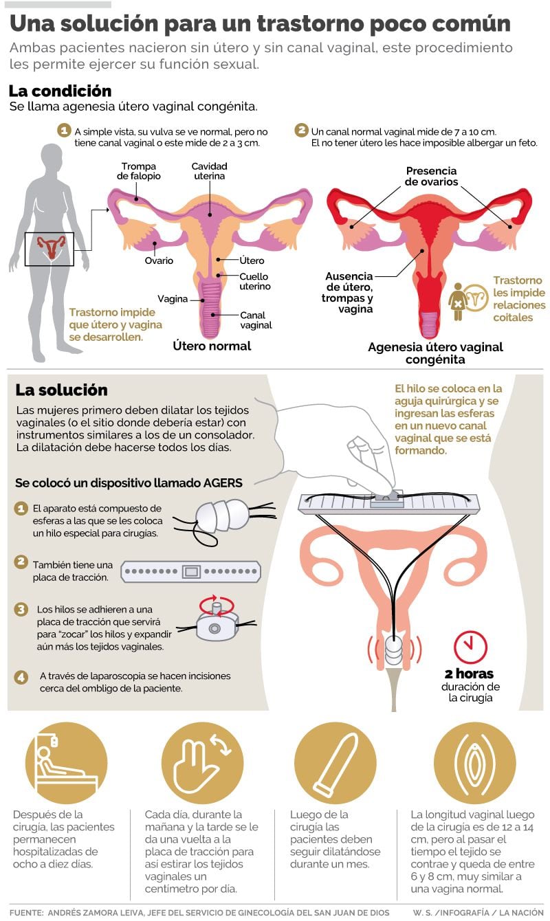 Ticas que nacieron sin vagina ahora tienen una gracias a nuevo  procedimiento en hospitales nacionales | La Nación